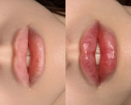 Губы, которые хочется есть — результат работы — фото 1
